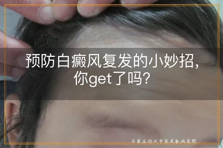 预防白癜风复发的小妙招，你get了吗？