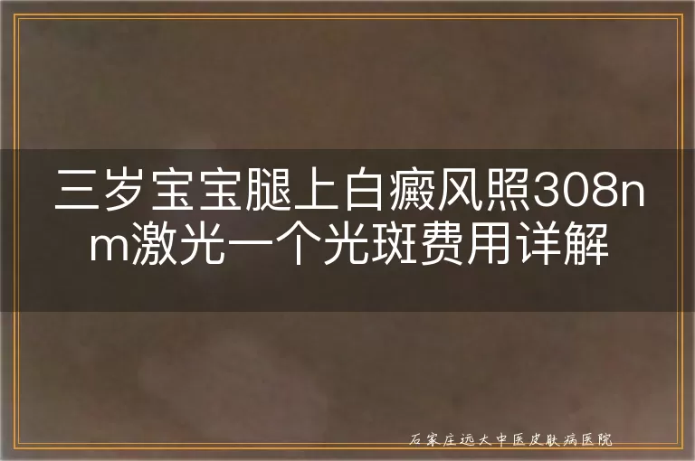 三岁宝宝腿上白癜风照308nm激光一个光斑费用详解