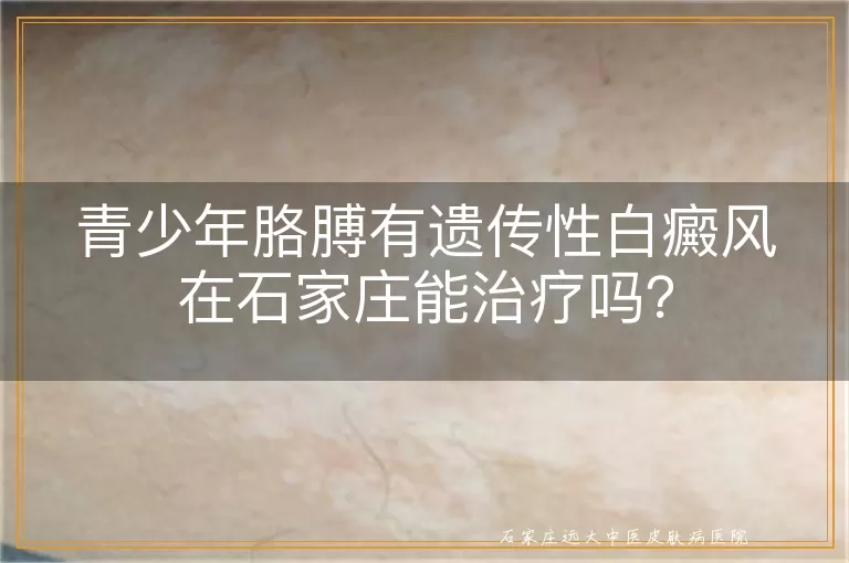 青少年胳膊有遗传性白癜风在石家庄能治疗吗？