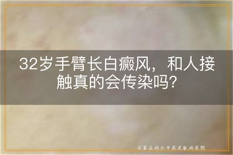 32岁手臂长白癜风，和人接触真的会传染吗？