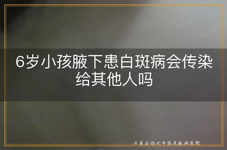 6岁小孩腋下患白斑病会传染给其他人吗
