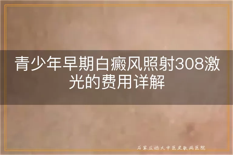 青少年早期白癜风照射308激光的费用详解