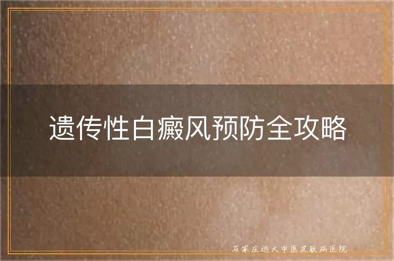 遗传性白癜风预防全攻略