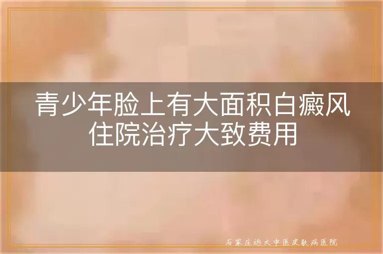 青少年脸上有大面积白癜风住院治疗大致费用