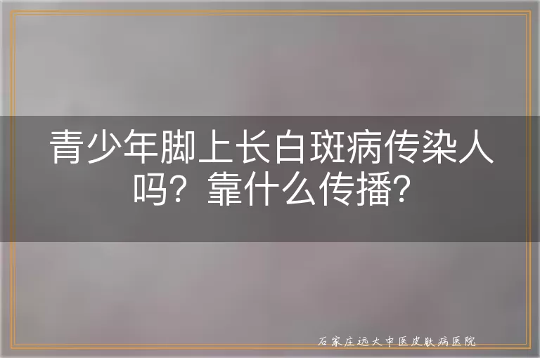 青少年脚上长白斑病传染人吗？靠什么传播？