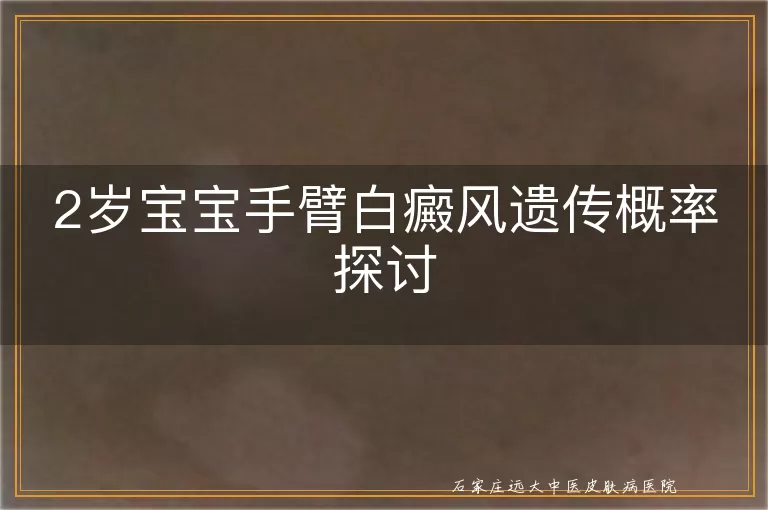 2岁宝宝手臂白癜风遗传概率探讨