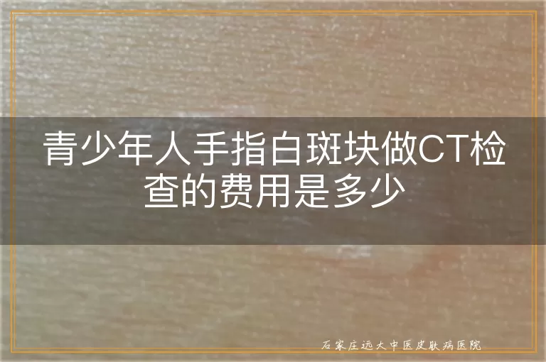 青少年人手指白斑块做CT检查的费用是多少