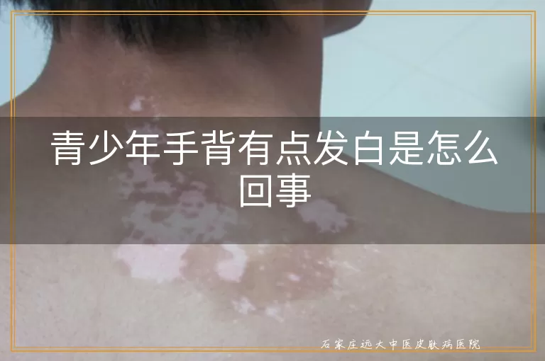 青少年手背有点发白是怎么回事