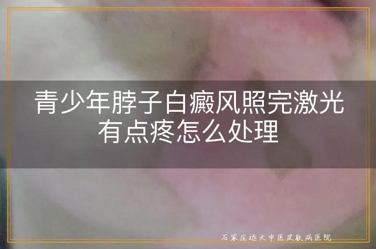 青少年脖子白癜风照完激光有点疼怎么处理