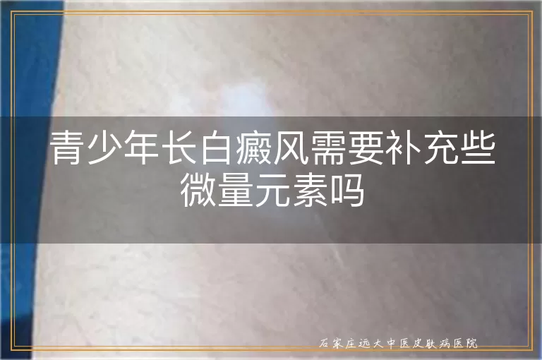 青少年长白癜风需要补充些微量元素吗