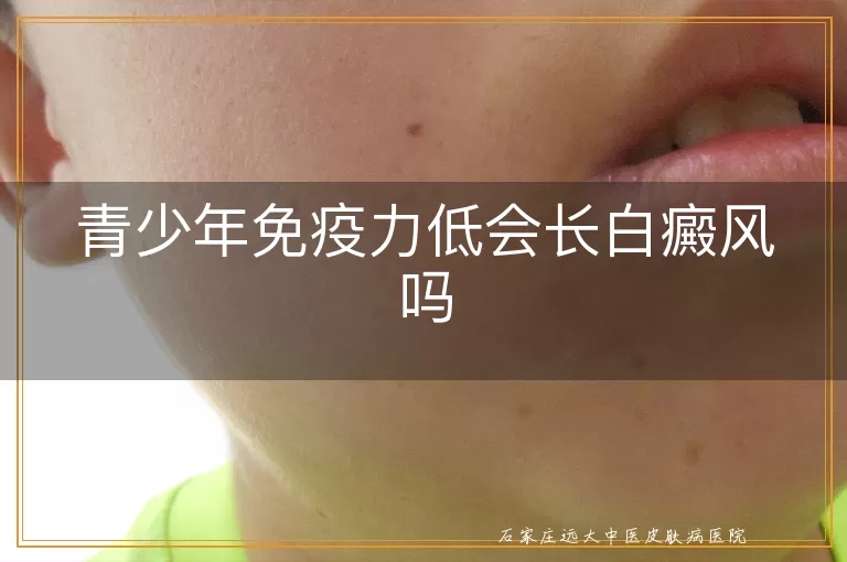 青少年免疫力低会长白癜风吗
