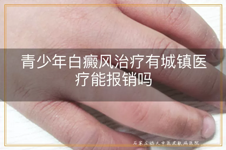 青少年白癜风治疗有城镇医疗能报销吗