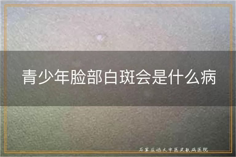 青少年脸部白斑会是什么病