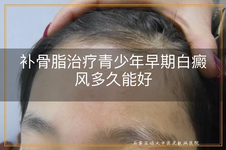 补骨脂治疗青少年早期白癜风多久能好