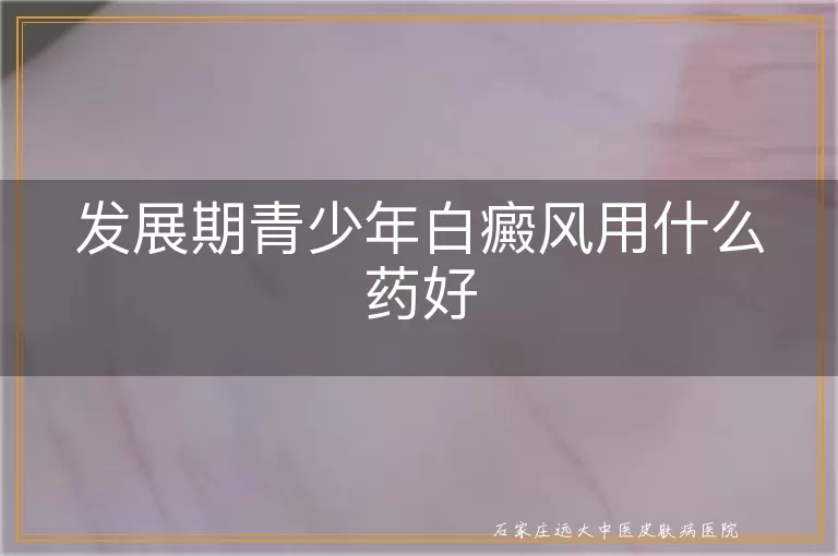 发展期青少年白癜风用什么药好