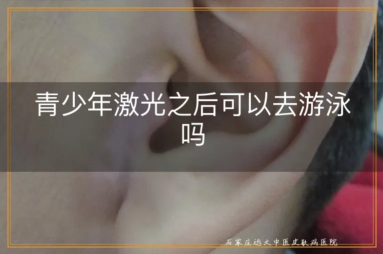 青少年激光之后可以去游泳吗