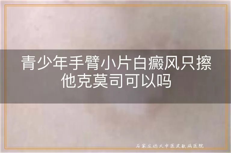 青少年手臂小片白癜风只擦他克莫司可以吗