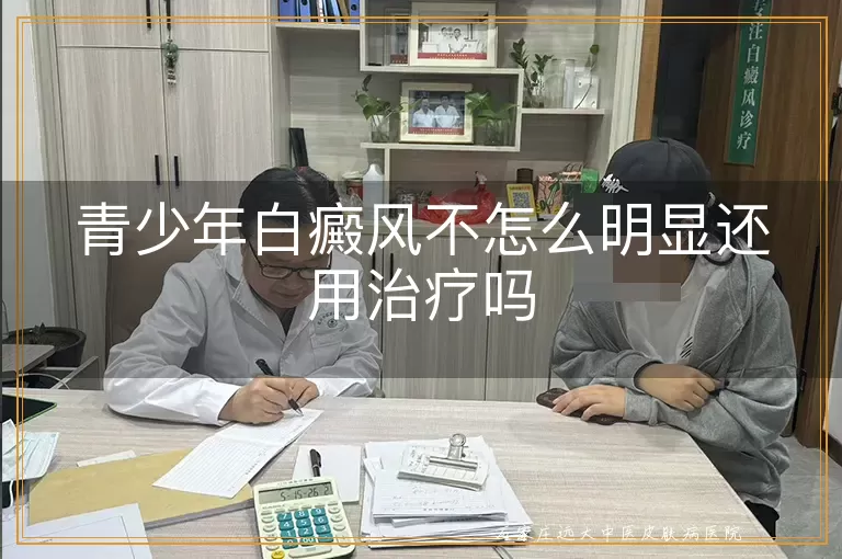 青少年白癜风不怎么明显还用治疗吗