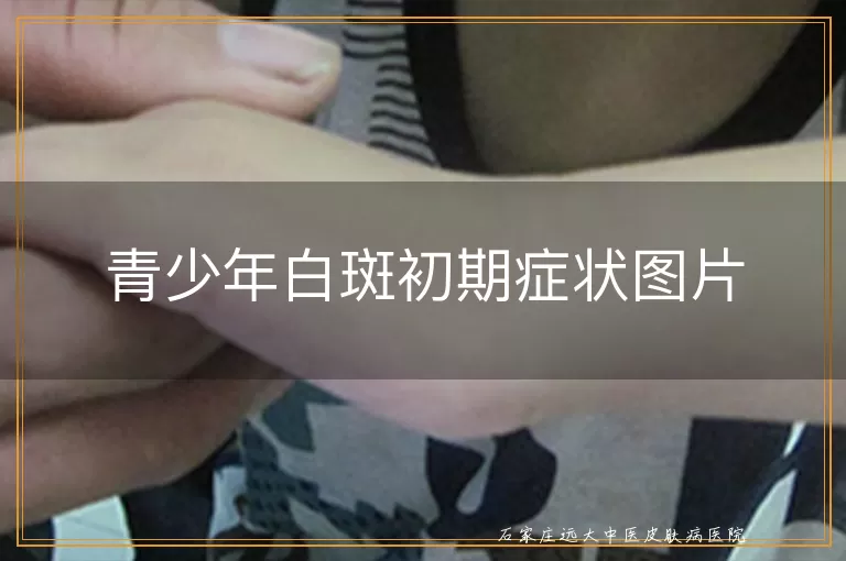 青少年白斑初期症状图片