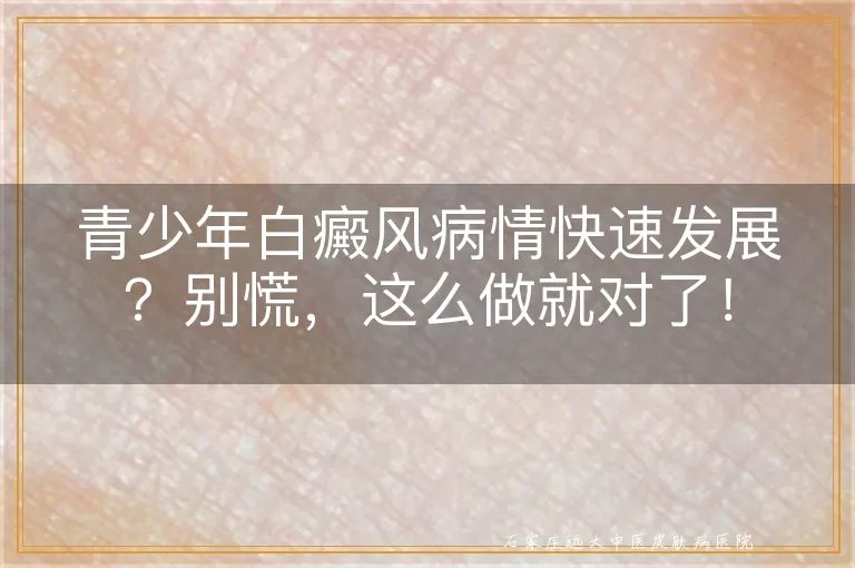 青少年白癜风病情快速发展？别慌，这么做就对了！