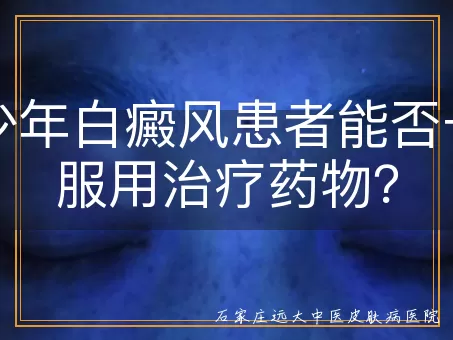 青少年白癜风患者能否长期服用治疗药物？