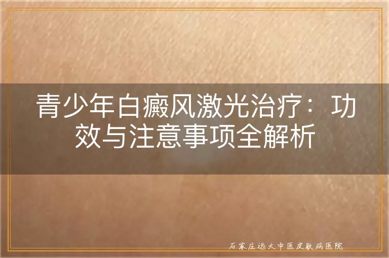 青少年白癜风激光治疗：功效与注意事项全解析
