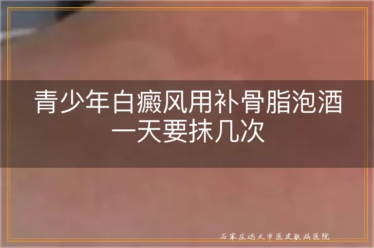 青少年白癜风用补骨脂泡酒一天要抹几次