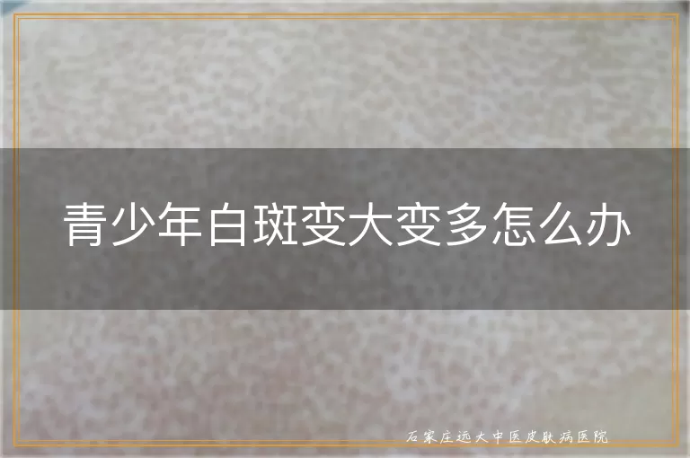 青少年白斑变大变多怎么办
