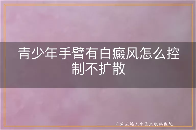 青少年手臂有白癜风怎么控制不扩散