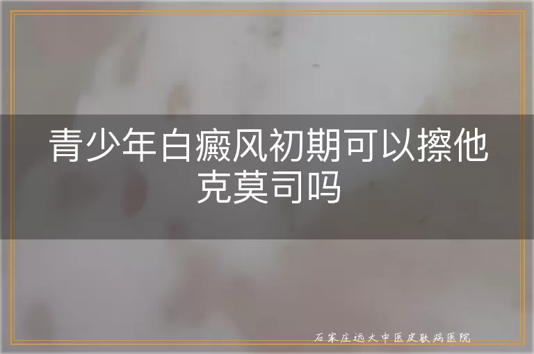 青少年白癜风初期可以擦他克莫司吗