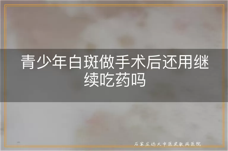 青少年白斑做手术后还用继续吃药吗