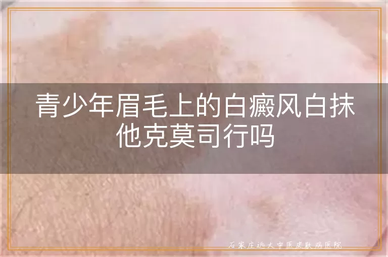 青少年眉毛上的白癜风白抹他克莫司行吗