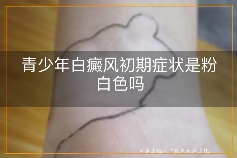 青少年白癜风初期症状是粉白色吗