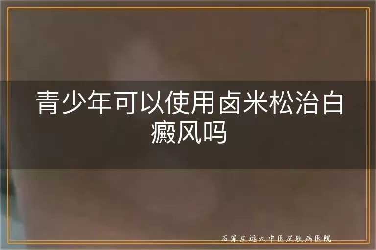 青少年可以使用卤米松治白癜风吗