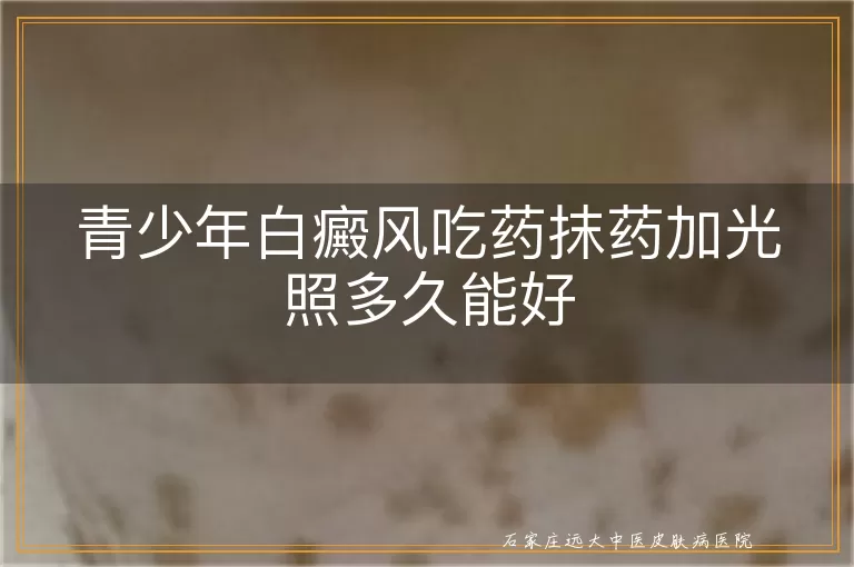 青少年白癜风吃药抹药加光照多久能好