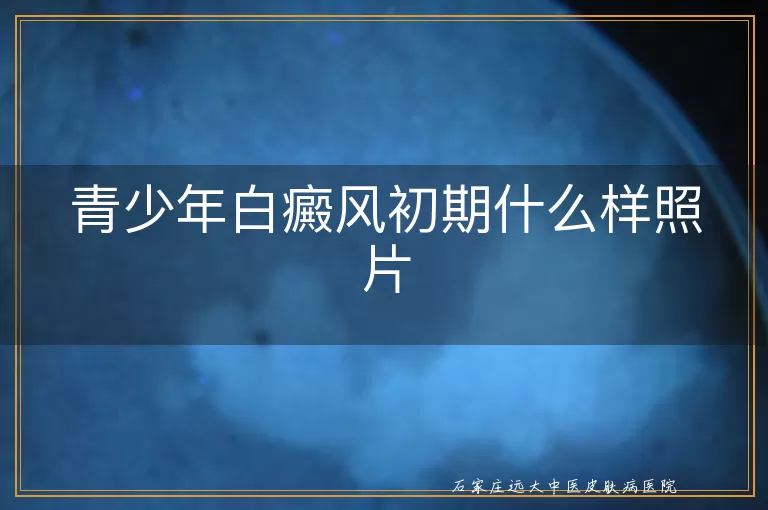青少年白癜风初期什么样照片