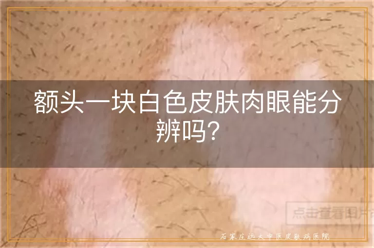 额头一块白色皮肤肉眼能分辨吗？