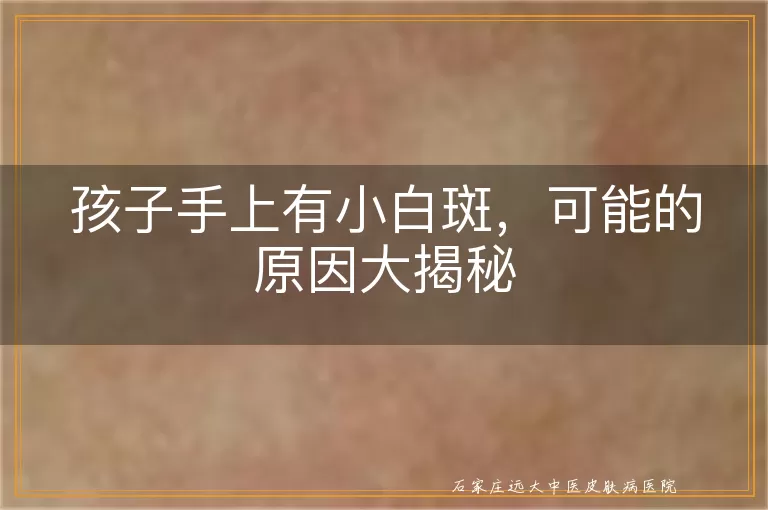 孩子手上有小白斑,可能的原因大揭秘