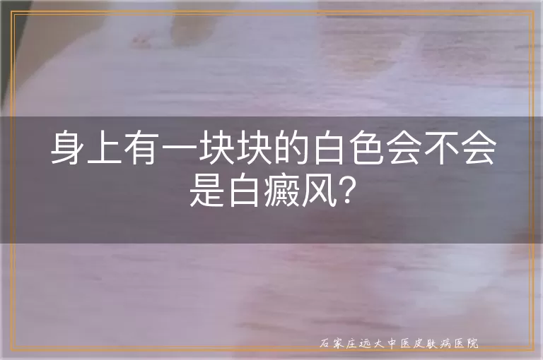 身上有一块块的白色会不会是白癜风？