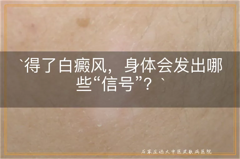 得了白癜风，身体会发出哪些“信号”？