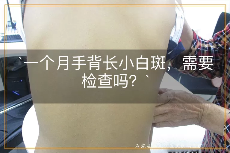 一个月手背长小白斑，需要检查吗？