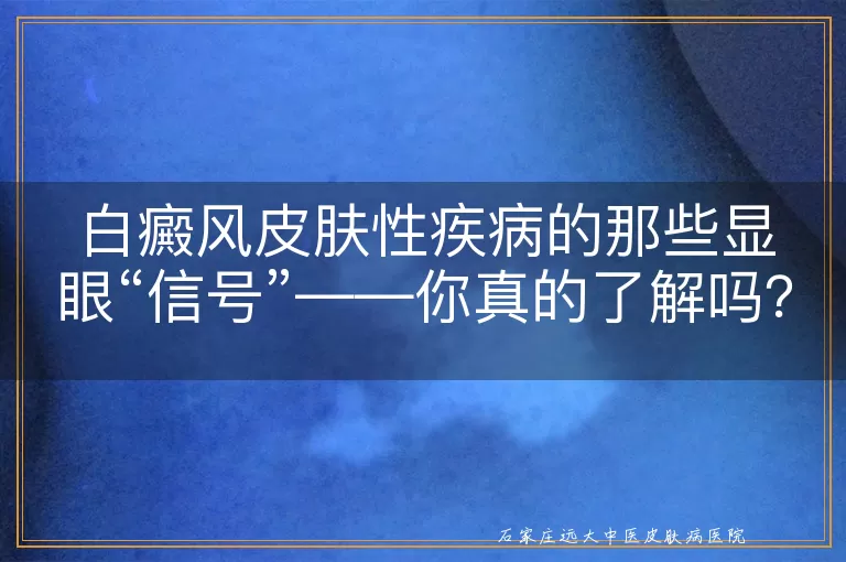 白癜风皮肤性疾病的那些显眼“信号”——你真的了解吗？