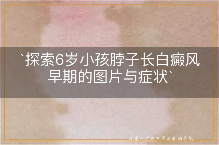 探索6岁小孩脖子长白癜风早期的图片与症状