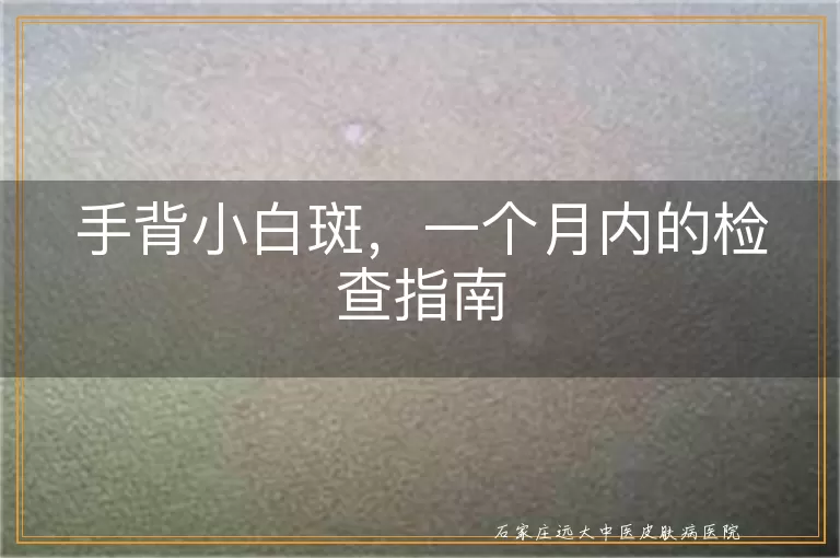 手背小白斑，一个月内的检查指南