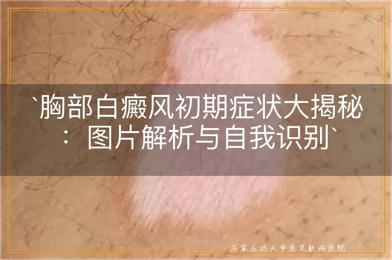 胸部白癜风初期症状大揭秘：图片解析与自我识别
