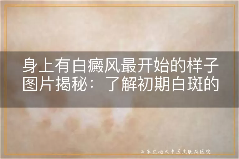 身上有白癜风最开始的样子图片揭秘：了解初期白斑的特征