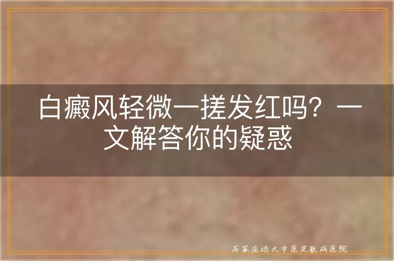 白癜风轻微一搓发红吗？一文解答你的疑惑