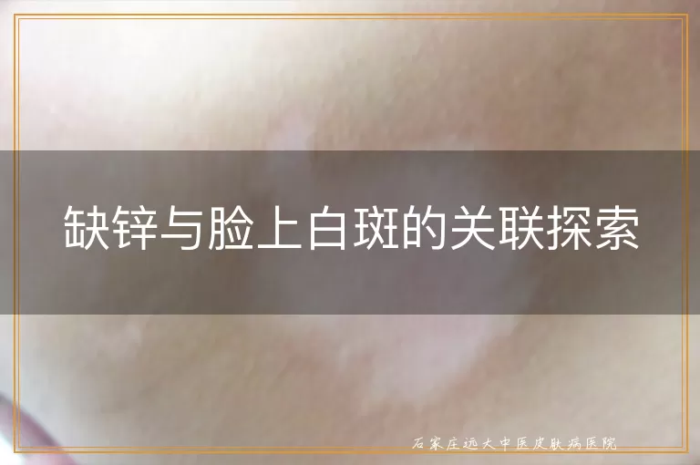 缺锌与脸上白斑的关联探索