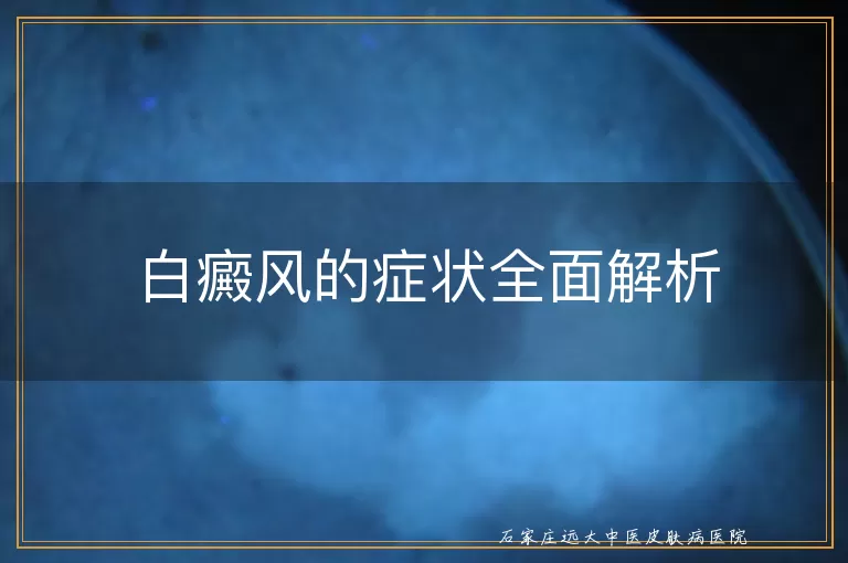 白癜风的症状全面解析