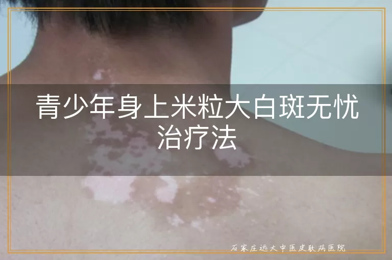 青少年身上米粒大白斑无忧治疗法